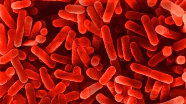 Legionella bacteria can cause a bacterial lung infections in people who are elderly or have other illnesses.