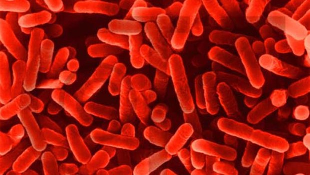 Legionella bacteria can cause a bacterial lung infections in people who are elderly or have other illnesses.