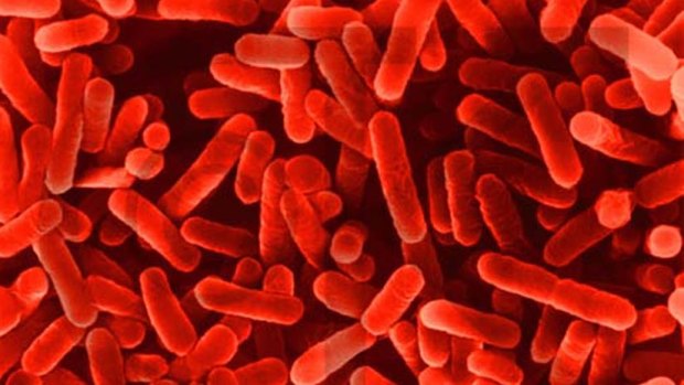 A patient who died at the facility was found to have legionella. 