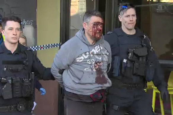 Jonathan Dick, with his face covered in blood, as he was arrested in Melbourne's CBD on Monday morning.
