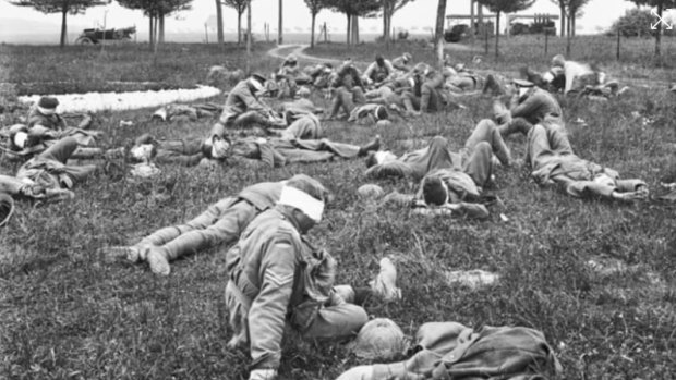 Gassed Australian soldiers at an over crowded aid post near Bois l’Abbé, 27 May 1918. They had been gassed in the operations at Villers-Bretonneux.