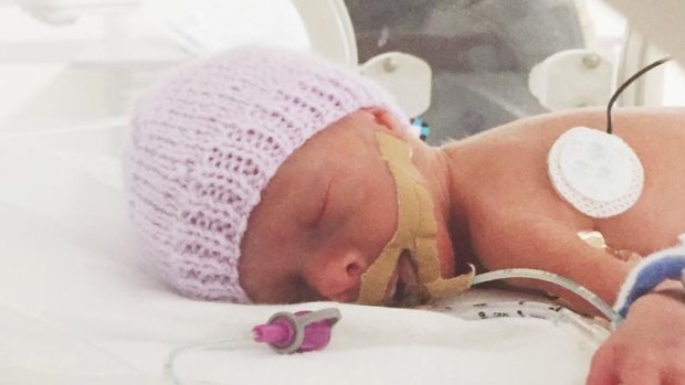 Pearl weighed just 690 grams when she was born and faces a tough few months in hospital.