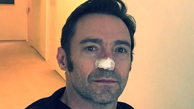 Hugh Jackman had his sixth skin cancer removed from his face.