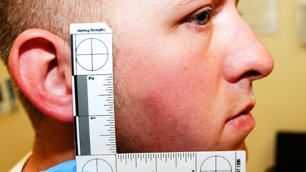 A photo of police officer Darren Wilson with a bruise on his face shortly after he fatally shot black teenager Michael Brown. The image was used as evidence by the grand jury.
