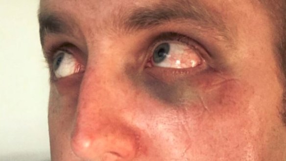 Teen accused of kicking police officer in the face back in custody for ...