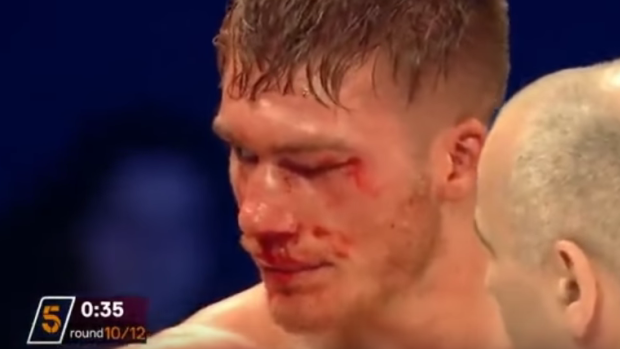 Damaged: Nick Blackwell's injuries during his fight against Chris Eubank Jnr.
