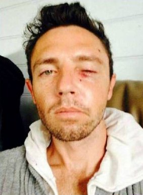 Peter Wells was left with serious facial injuries after the attack. 