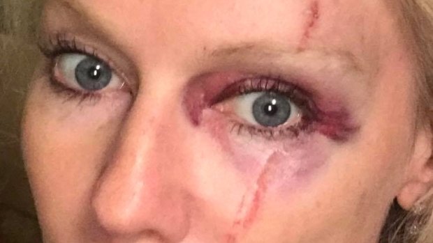 Shari Lea Hitchcock has spoken to police after claiming she was assaulted.