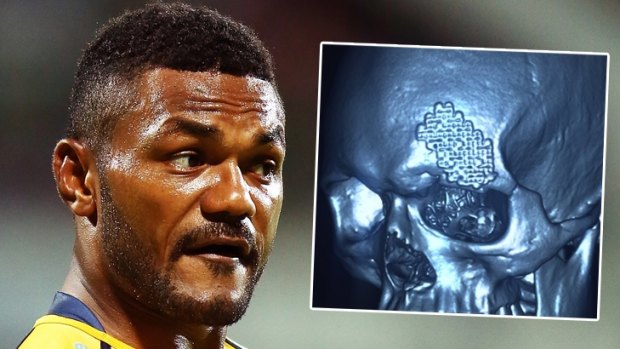 Henry Speight had already broken his skull in 2016, now's he has a medial ligament tear in his knee.
