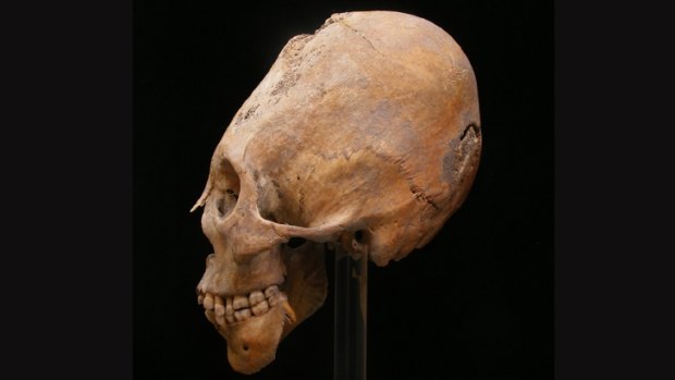 Huns and other nomadic populations in central Asia sometimes bound infants' skulls to modify their shapes.