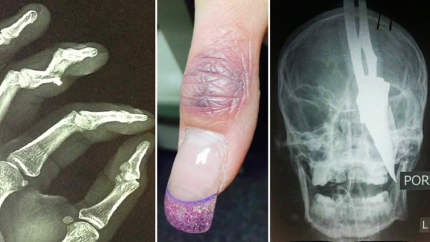 Pain points: X-rays and images shared by doctors and medical staff on Figure 1.