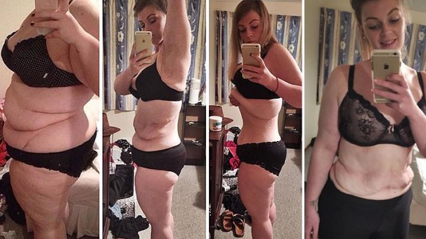 Elora Harre documented her 55 kilogram weight loss over two years. 