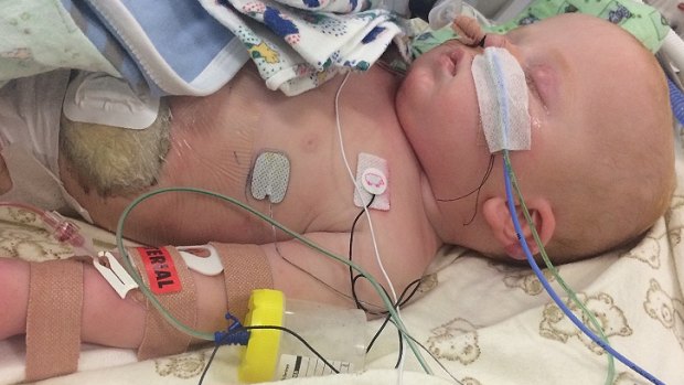 Baby Mason Window was severely ill and hospitalised with a flesh-eating bacteria.