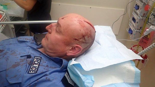 The officer was rushed to Royal Perth Hospital where he received a number of stitches to his wound.  