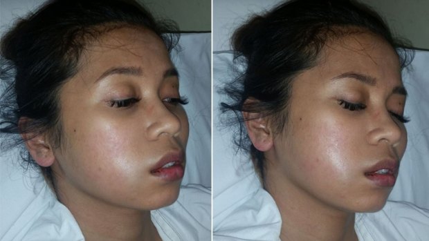 The victim posted to social media to display the swelling on her face and call for information.