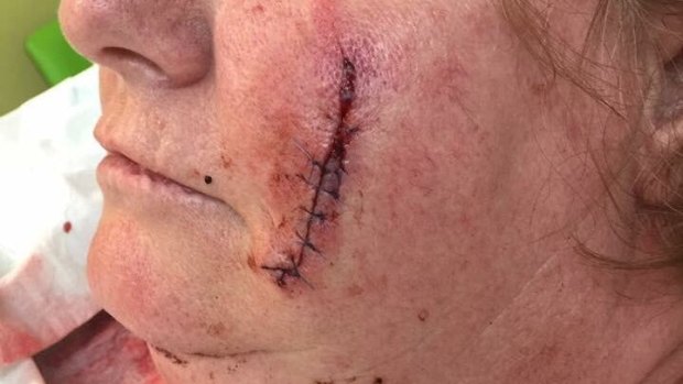 The woman was dragged from her car and attacked on Monday night.