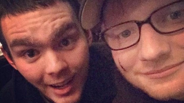 A photo posted on Twitter shows Ed Sheeran's facial cut as he poses with a fan. 