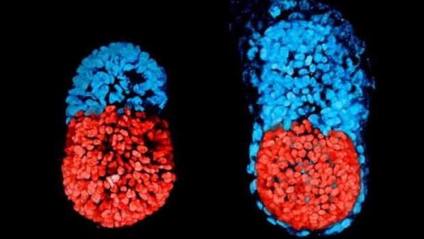 Artificial mouse embryos grow in the lab.