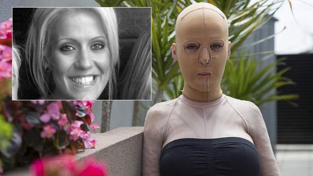 Burn victim Dana Vulin as she appeared on Seven's Sunday Night program and (inset) before the fire attack.
