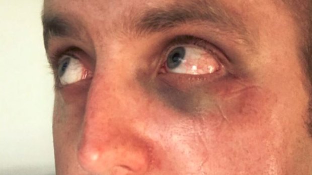 The police officer who was assaulted at Highpoint on December 26, 2017. Supplied by the Police Association.