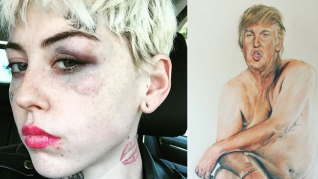 Artist Illma Gore after her assault, left, and her drawing of Donald Trump. 