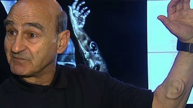 Performance artist Stelarc shows off his new ear.