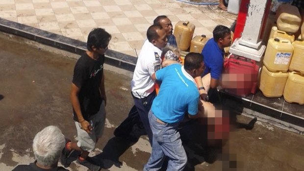 Karangasem police chief Sugeng Sudarso said one passenger had lost both feet in the blast.