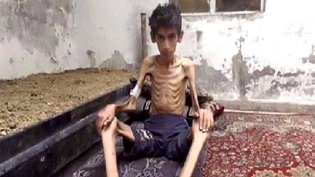 This undated photo was one of the images that brought attention to the plight of Madaya's citizens.