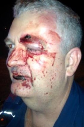 Queensland Ambulance Service paramedic Brad Johnson suffered cuts, bruises and a black eye during an assault while on the job.