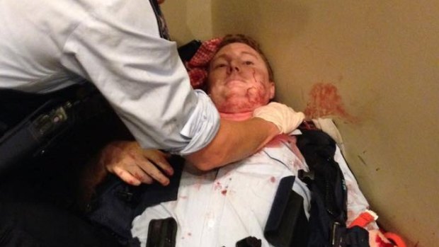 Senior Constable Luke Weiks after the attack.
