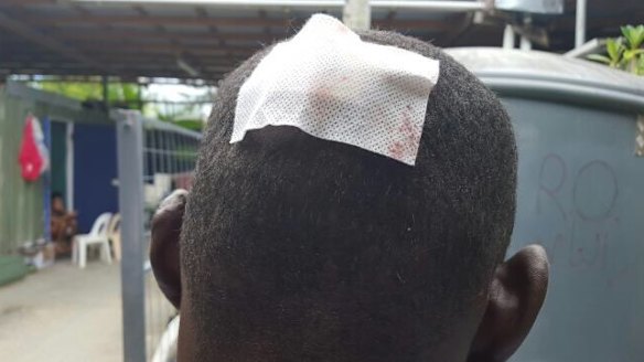 A photograph showing an injury allegedly sustained in the Good Friday incident at Manus Island regional processing centre.