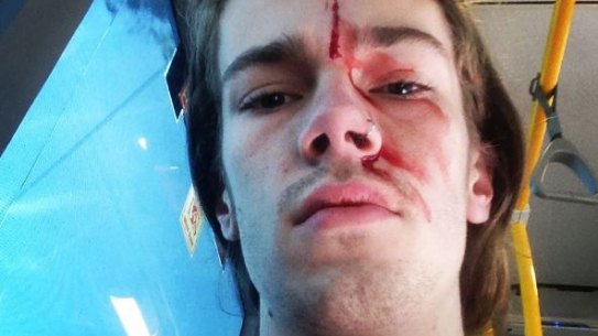 Sean Foster claims he was attacked while trying to stop another man removing rainbow 'Vote Yes' posters from a bus stop in Brisbane.