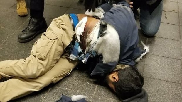 New York bomb suspect Akayed Ullah in the moments after the explosion.