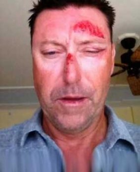 Robert Allenby following his ordeal.