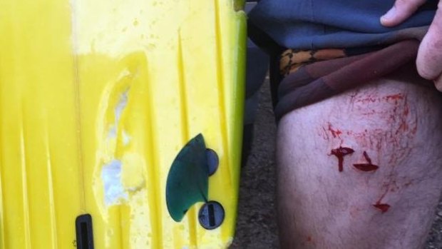 An image posted to social media shows several deep wounds to the surfer's thigh and bite marks on his surfboard.