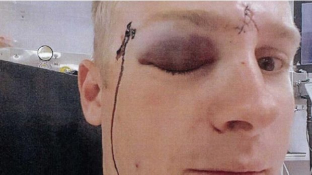 Senior Constable Daniel Yeoman suffered a fractured eye socket, facial scarring and nerve damage.