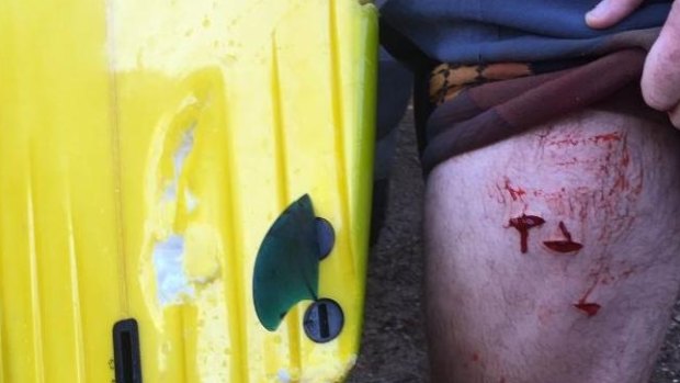 An image posted to social media shows several deep wounds to the surfer's thigh and bite marks on his surfboard. 