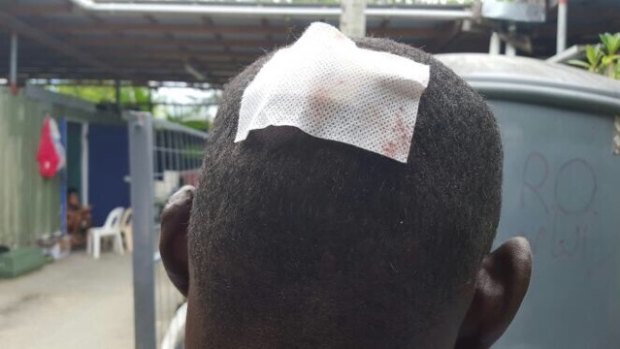 A Sudanese refugee received stitches after being hit by rock.