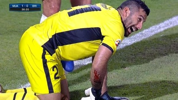 Brisbane Roar goalkeeper Jamie Young after injuring his arm on a rusty hook in the AFC match against Muangthong United. 