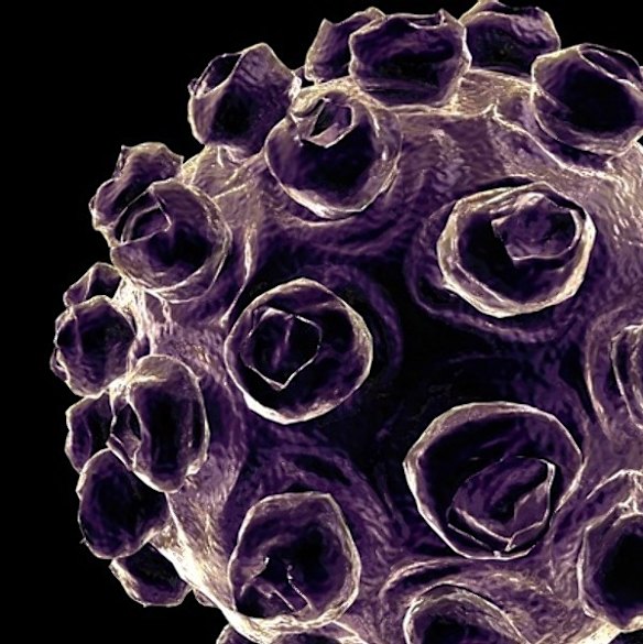 A measles virus under a microscope.