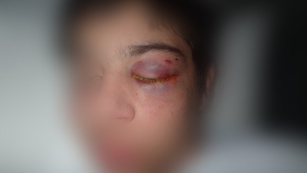 A police photo of the victim of the alleged assault.