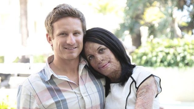 Turia Pitt with her partner Michael Hoskin.