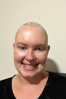 Triple Negative Breast Cancer story
