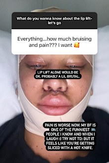 MAFS bride Coco hold Q&A on lip lift 