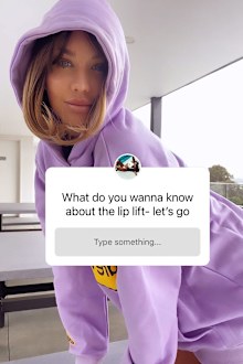 MAFS bride Coco hold Q&A on lip lift 
