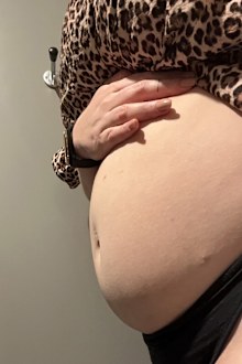 No, Caitlin Tiernan isn't pregnant - this is just bloating from endometriosis.