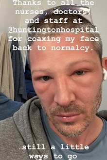 Zach Gilford shares shocking health update