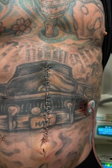 Carey hart in hospital