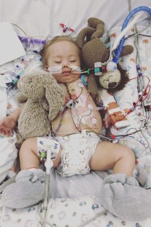 Grayson was born at 37 weeks gestation via an emergency caesarean section and was home for just five weeks before going into heart failure.