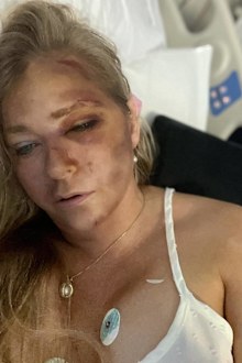 Virginia Roberts Giuffre claims she has only days to live after suffering injuries in a bus crash in Western Australia, April 1 2025.